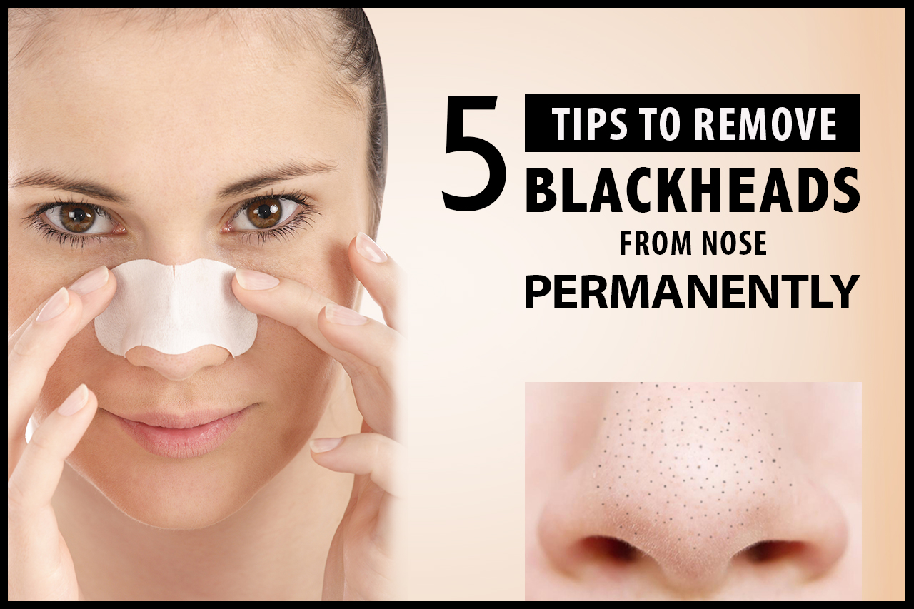 How Can I Remove Blackheads On My Face Nose Strips Get A Grip Of The Tip Of The Blackhead And