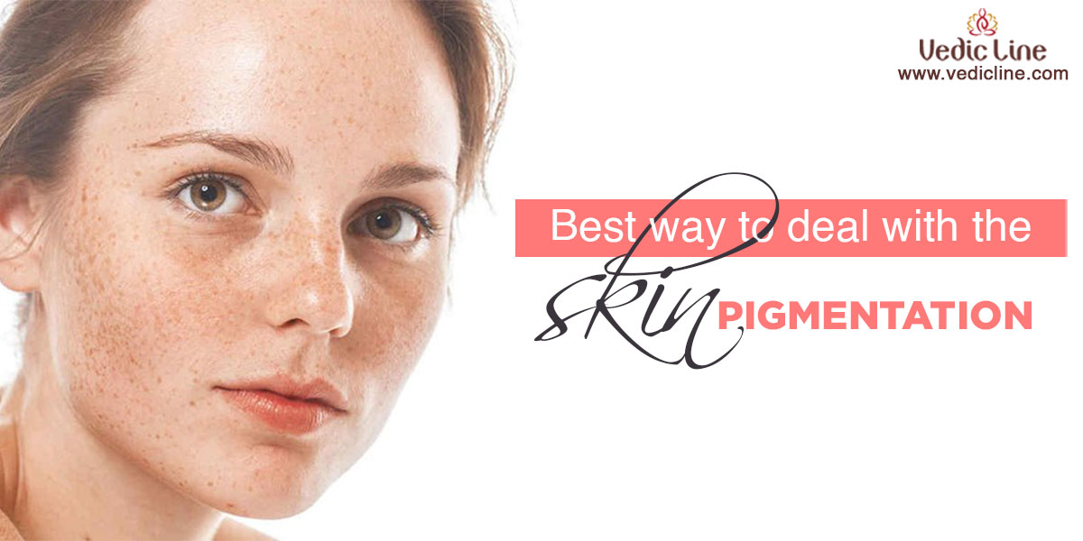 Hyperpigmentation treatment & Best way to deal with the skin pigmentation