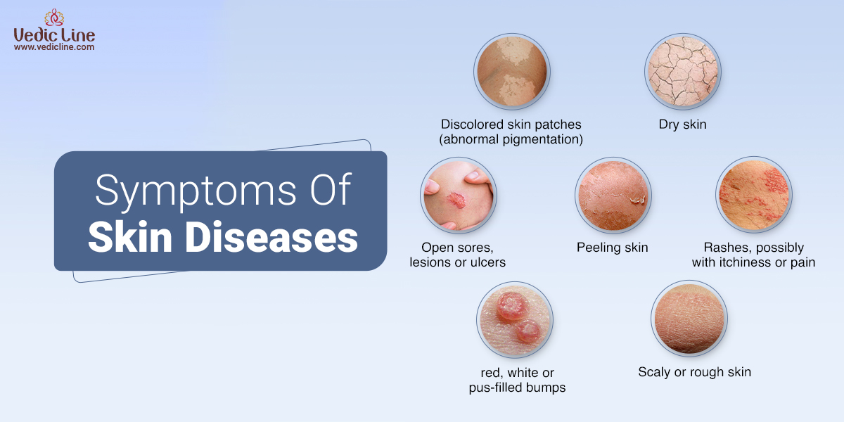 Types of skin diseases and there side effects | Vedicline