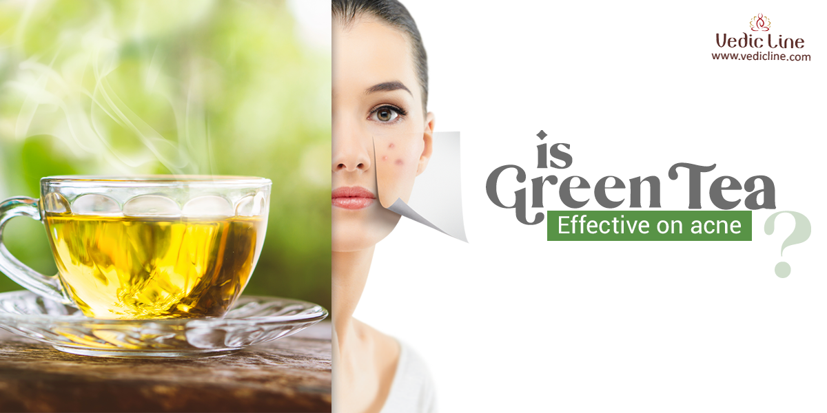 Green tea benefits for skin and How to Make Use Of It Vedicline