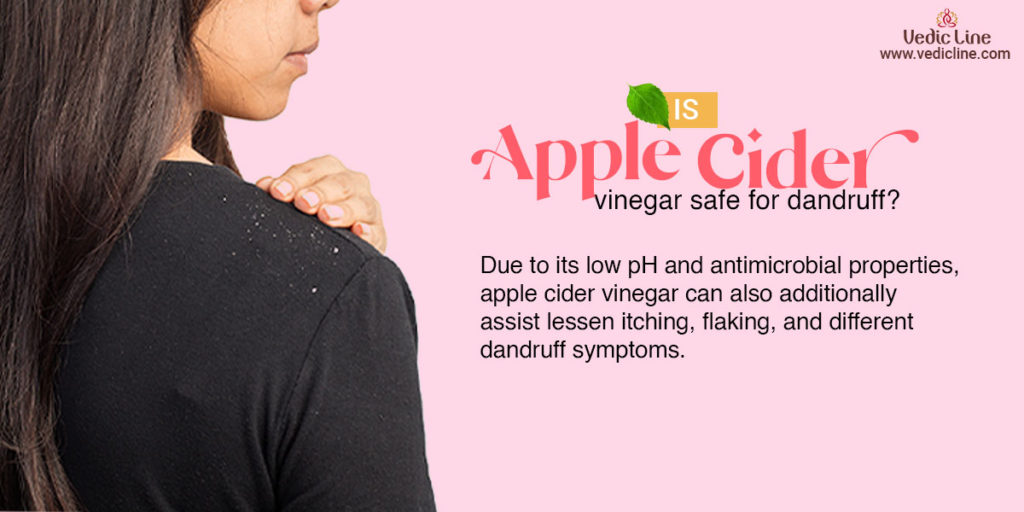 Apple cider vinegar safe for dandruff