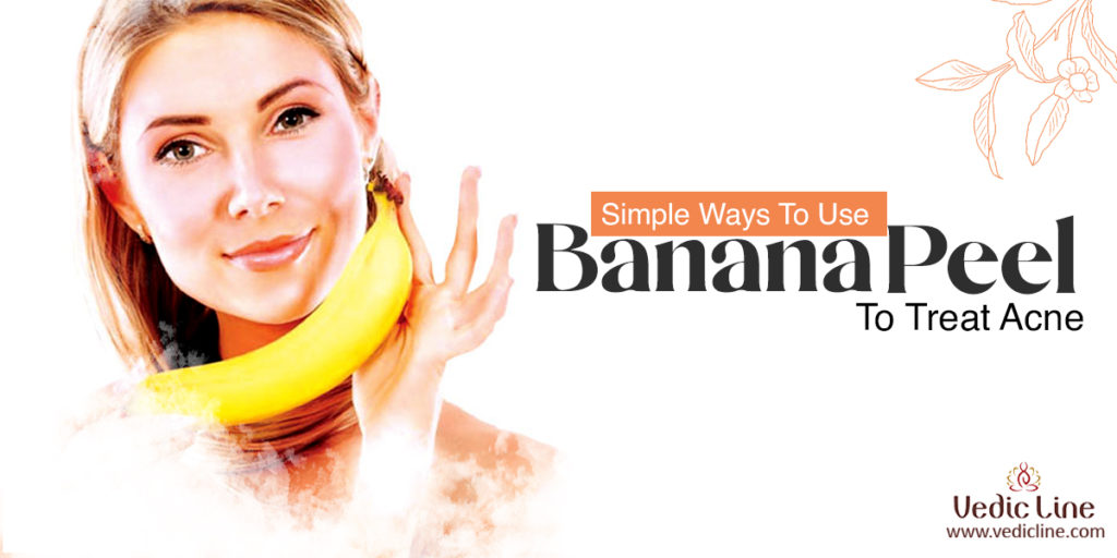 5 Easy Ways To Treat Acne With Banana Peel Vedicline