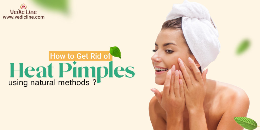 How to Get Rid of Heat Pimples Fast Using Natural Methods - Vedicline