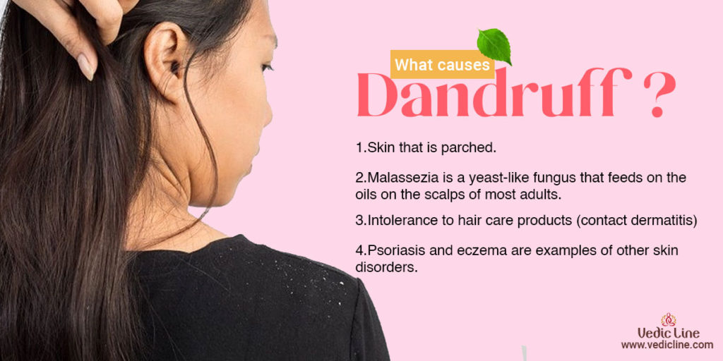 what causes dandruff