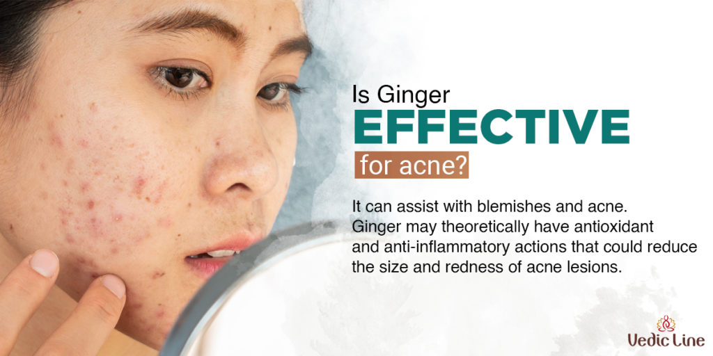 Ginger effective on acne