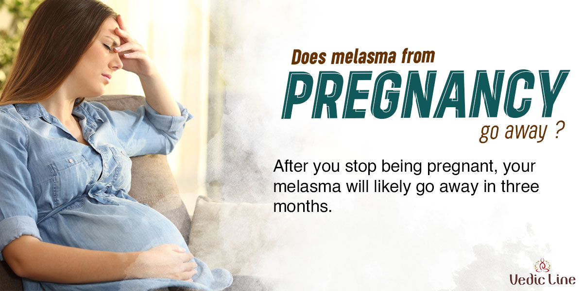 A Brief Overview of Melasma During Pregnancy Vedicline
