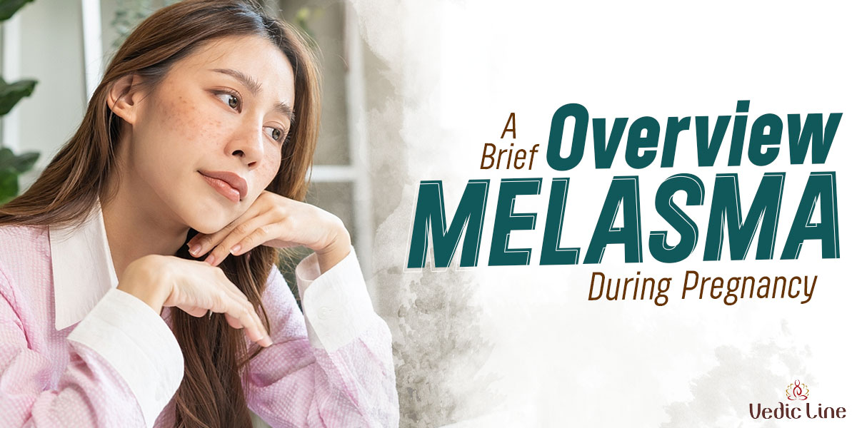 melasma during pregnancy