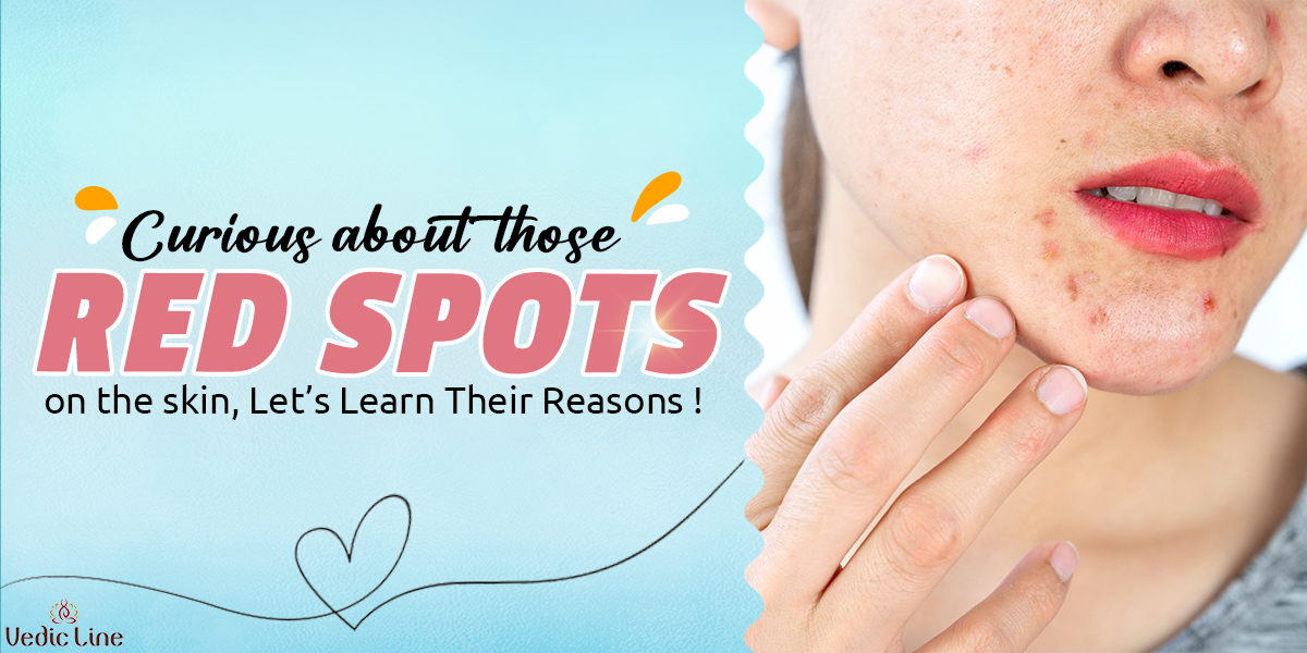 Red Spots on the skin, Let's Learn Their Reasons - Vedicline