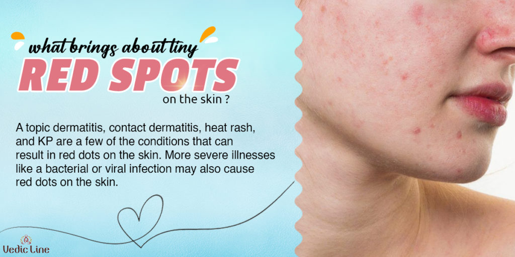 Red spots deals on skin